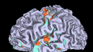 Il cervello non &egrave; uno solo, in realt&agrave; sono due organi distinti