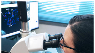 Tumori, una sonda a fibra ottica per bruciare le cellule malate