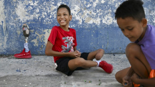 "Je voudrais qu'on m'op&egrave;re": le r&ecirc;ve sportif en suspens d'un enfant cubain