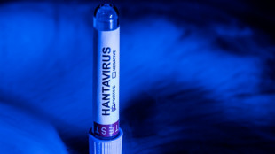 For hantavirus, experts aim to inform without igniting Covid panic
