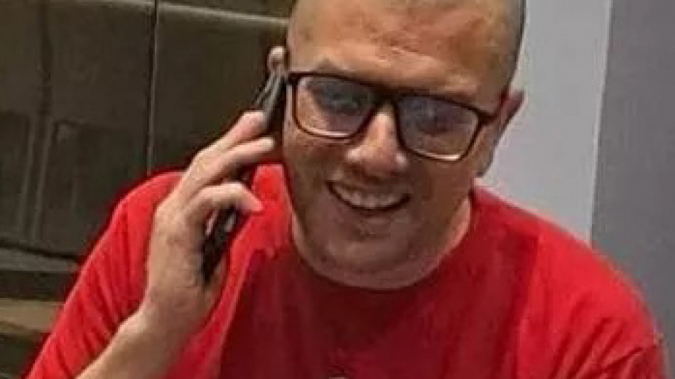 Trentini e il look completamente rasato, 'non l'ha scelto lui'